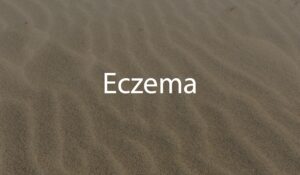 Link to Eczema webpage